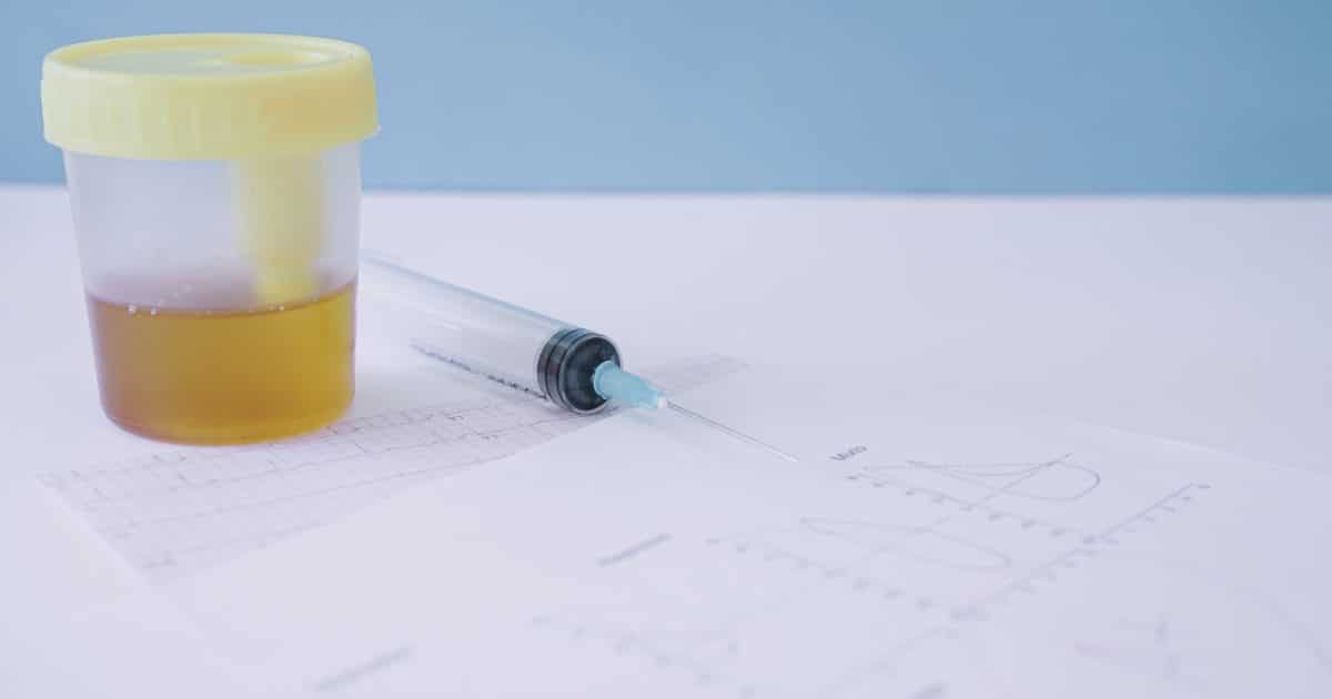 exame-de-urina-turva