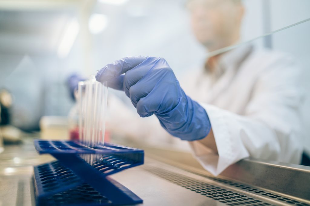 imagem aproximada de uma mão, vestindo luva cirúrgica em laboratório para análise de espermocultura