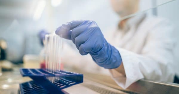 imagem aproximada de uma mão, vestindo luva cirúrgica em laboratório para análise de espermocultura