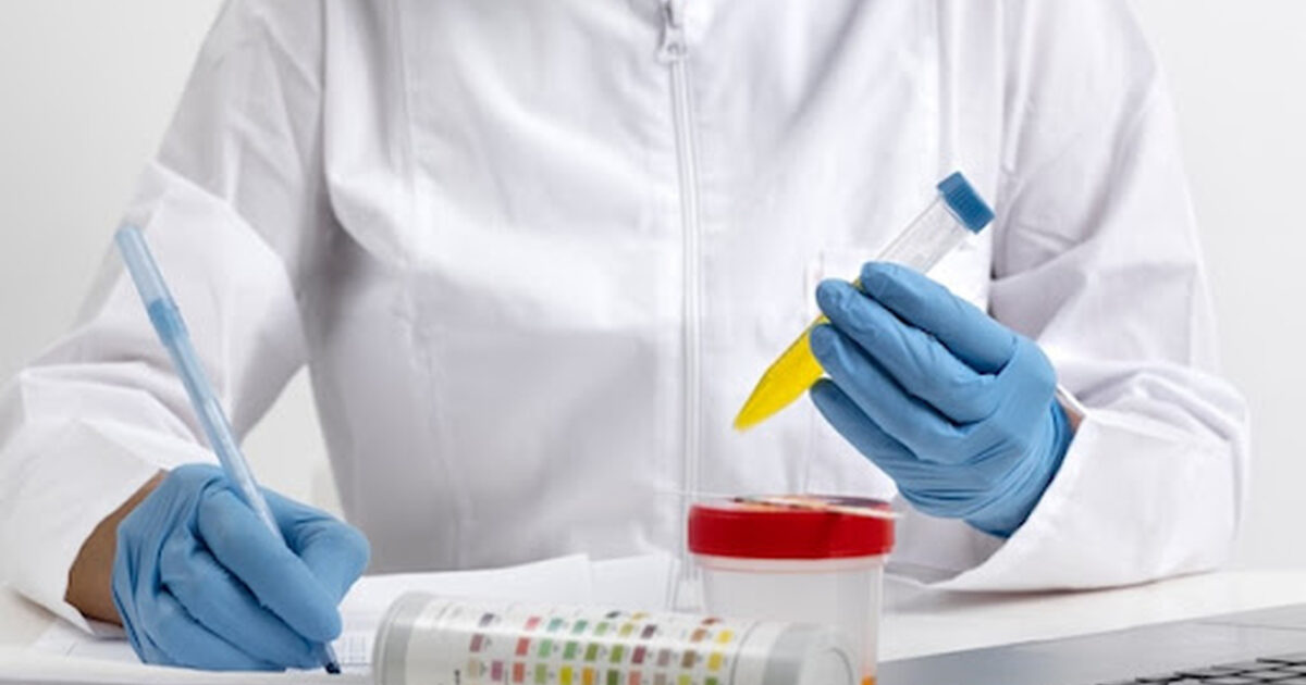 Imagem de uma pessoa examinando os exames de urina para simbolizar a urofluxometria